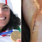 brignone ginocchio operato