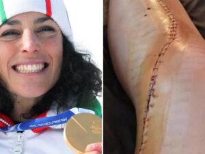 brignone ginocchio operato